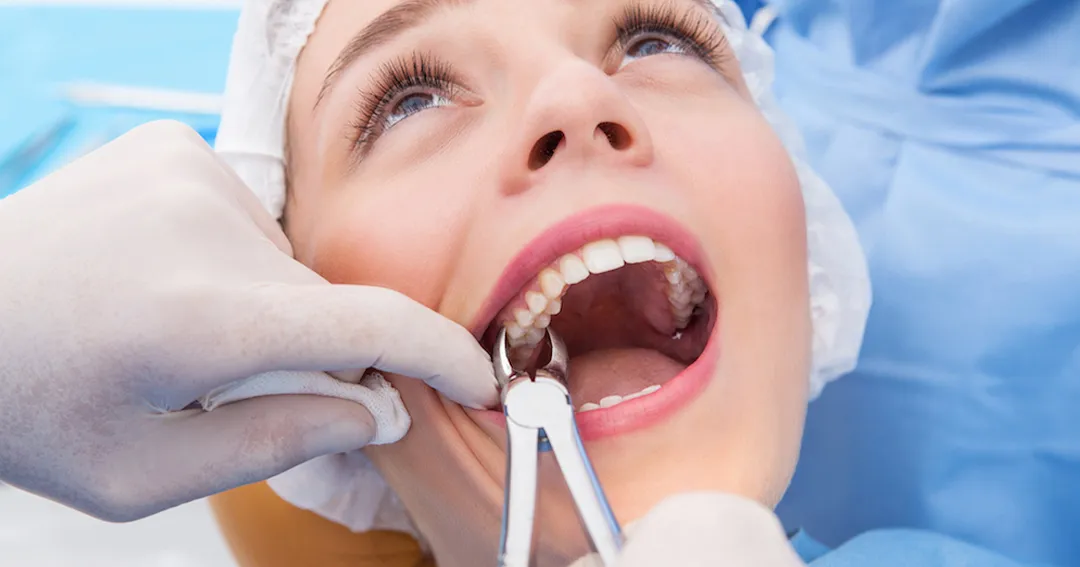 dentinst doing tooth extraction service