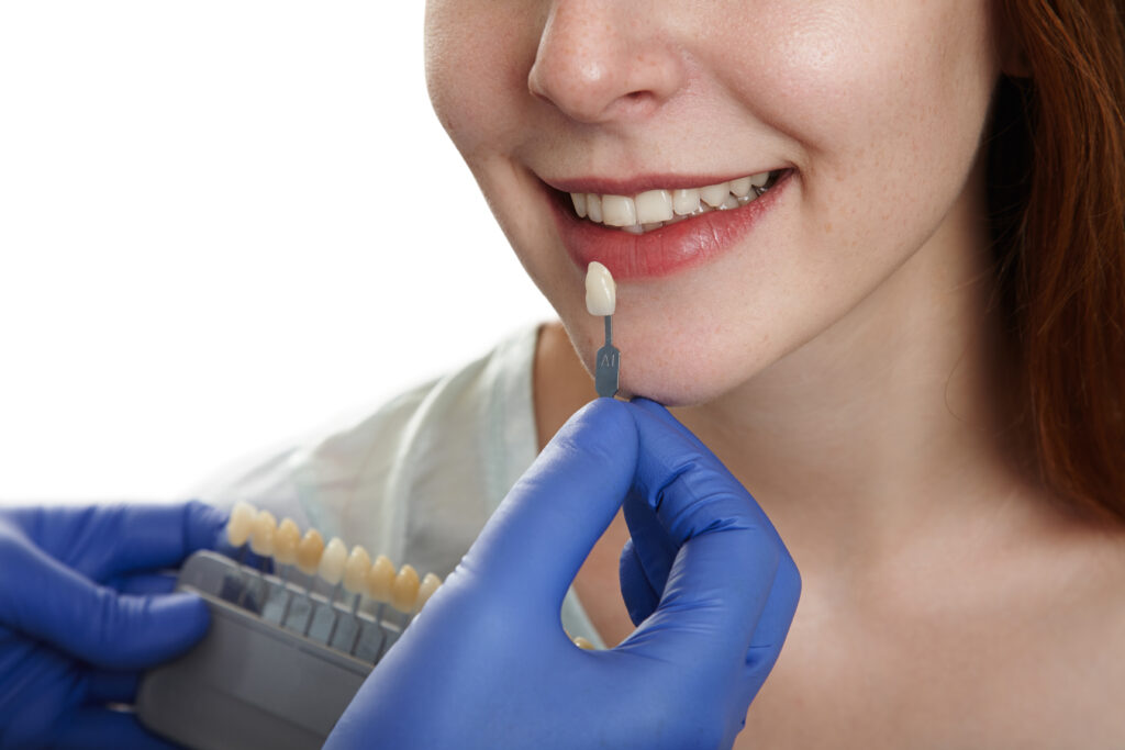 Doctor test teeth colour to patient to apply veneer