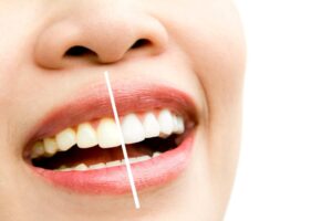What’s Better: In Office or At Home Teeth Whitening?