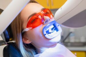 Why Teeth Whitening Clinics Are Still the Best Choice