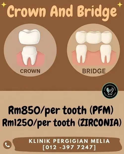 pricing crown and bridge - KP Melia